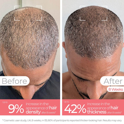 Healthy Hair Bundle